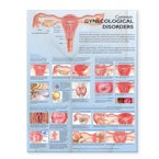 Common Gynecological Disorders Anatomical Chart