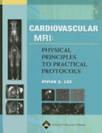 Cardiovascular MR Imaging