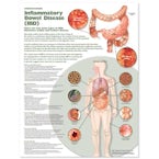 Understanding Inflammatory Bowel Disease (IBD) Anatomical Chart