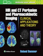 MR and CT Perfusion and Pharmacokinetic Imaging: Clinical Applications and Theoretical Principles