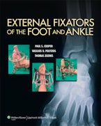 External Fixators of the Foot and Ankle