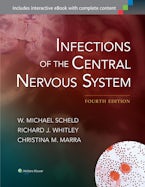 Infections of the Central Nervous System
