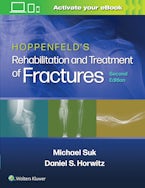 Hoppenfelds Treatment and Rehabilitation of Fractures