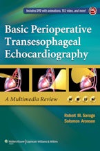 Basic Perioperative Transesophageal Echocardiography