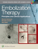Embolization Therapy: Principles and Clinical Applications