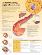 Understanding High Cholesterol Lam