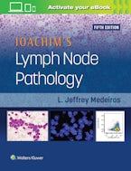 Ioachim’s Lymph Node Pathology