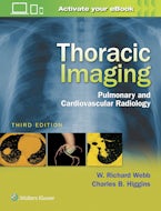 Thoracic Imaging