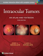 Intraocular Tumors: An Atlas and Textbook