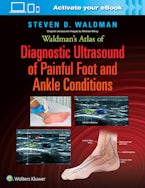 Waldman’s Atlas of Diagnostic Ultrasound of Painful Foot and Ankle Conditions