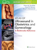 Atlas of Ultrasound in Obstetrics and Gynecology