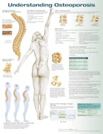 Understanding Osteoporosis