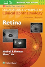 Retina