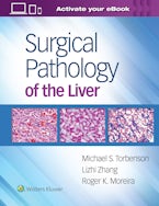 Surgical Pathology of the Liver
