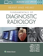Brant and Helms Fundamentals of Diagnostic Radiology