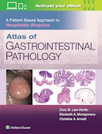 Atlas of Gastrointestinal Pathology: A Pattern Based Approach to Neoplastic Biopsies