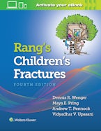 Rang’s Children’s Fractures