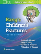 Rangs Childrens Fractures