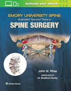 Emorys Illustrated Tips and Tricks in Spine Surgery