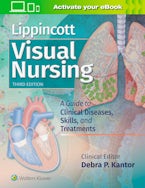 Lippincott Visual Nursing