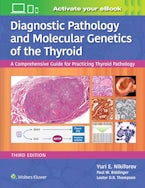 Diagnostic Pathology and Molecular Genetics of the Thyroid