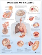 Dangers of Smoking Anatomical Chart