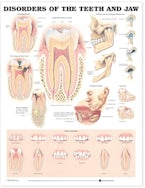 Disorders of the Teeth and Jaw Anatomical Chart