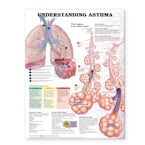 Understanding Asthma Anatomical Chart