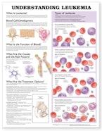Understanding Leukemia Anatomical Chart