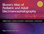 Blume’s Atlas of Pediatric and Adult Electroencephalography