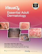 VisualDx: Essential Adult Dermatology