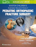 Boston Children’s Illustrated Tips and Tricks in Pediatric Orthopaedic Fracture Surgery