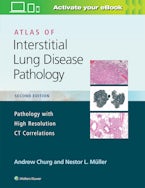 Atlas of Interstitial Lung Disease Pathology