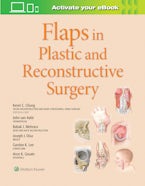 Flaps in Plastic and Reconstructive Surgery