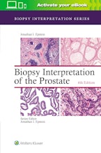 Biopsy Interpretation of the Prostate