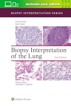Biopsy Interpretation of the Lung