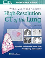 Webb, Müller and Naidichs High-Resolution CT of the Lung