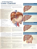 Understanding Liver Cancer Anatomical Chart