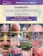 Goodheart’s Same-Site Differential Diagnosis